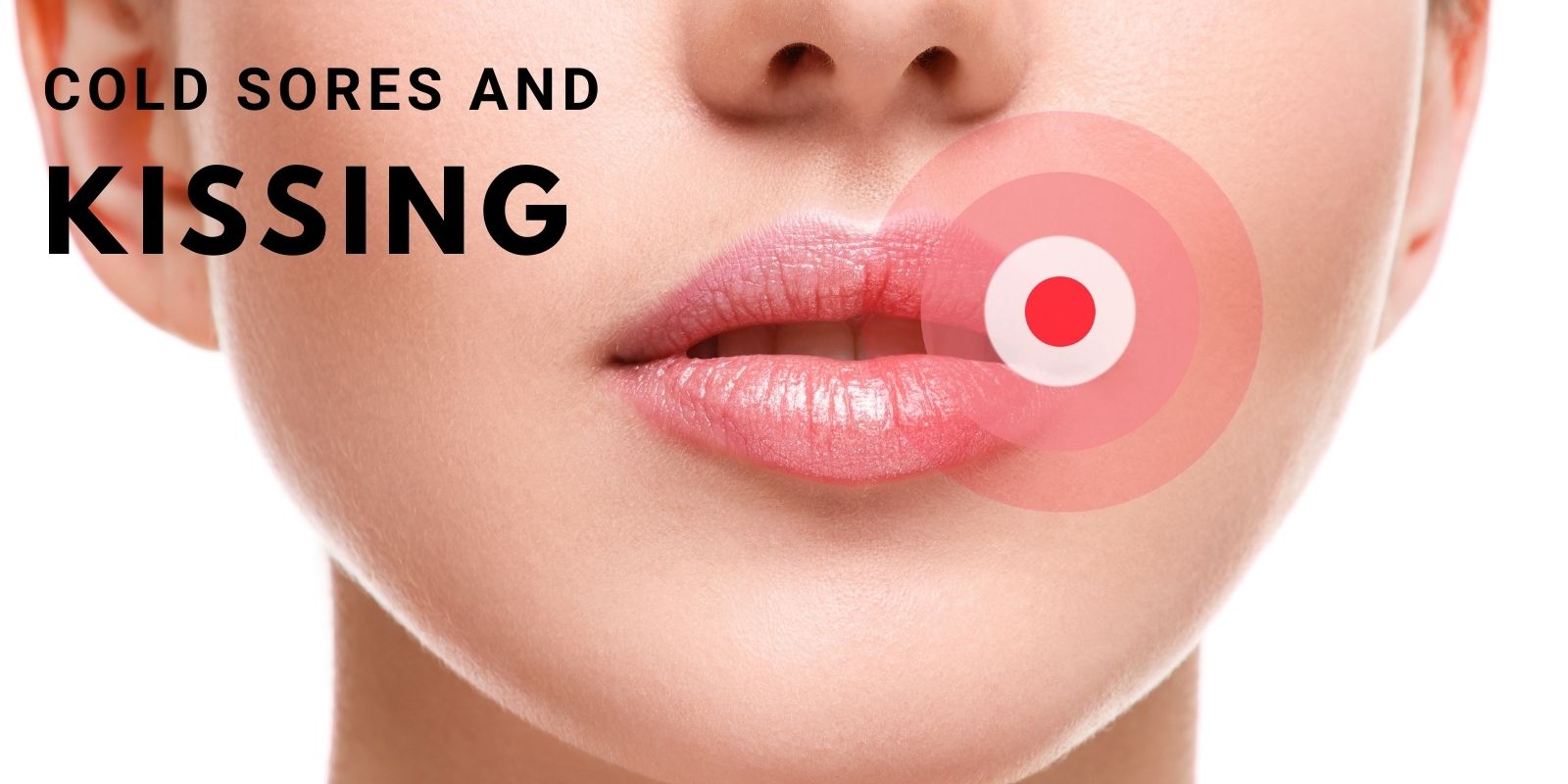 making out with cold sores